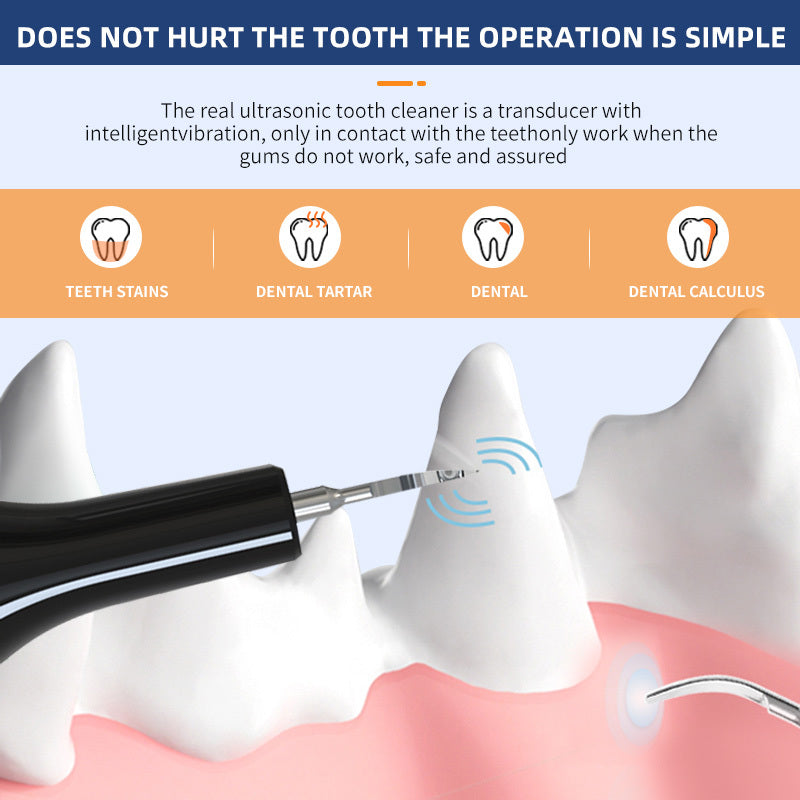 Ultrasonic Pet Teeth Cleaning Device & Deep Clean Plaque Remover for Dogs & Cats